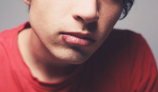 嘴上长泡但是不疼,嘴上长泡了是怎么回事