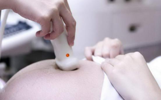 孕妇待产输液,操作失误被输酒精,这很危险