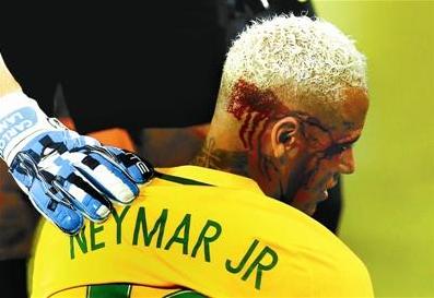 心疼！内少血染赛场足坛那些血染赛场的硬汉们