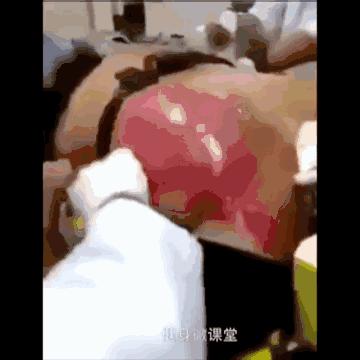 外国男子连喝25罐红牛,一位男子喝25罐红牛现在怎么样了