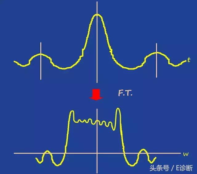 磁共振伪影及解决方案,e系列诊断