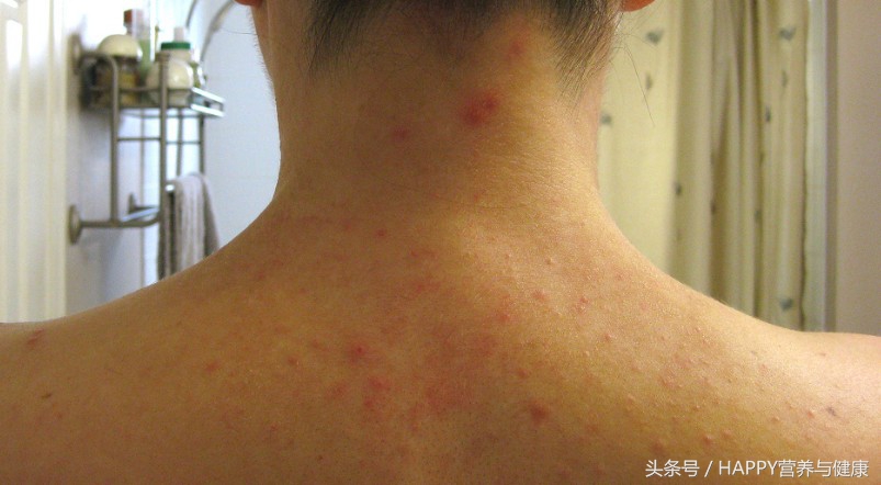 皮肤科怎么治疗长疮,皮肤疮的症状有哪些