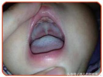 春天容易上火应该怎样预防,宝宝上火的症状和预防措施