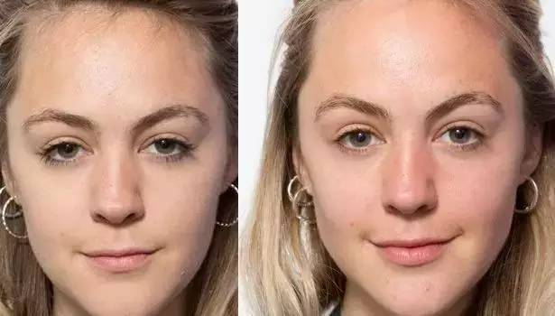 熬夜会让你变得多丑,熬夜变丑了还要继续熬夜么