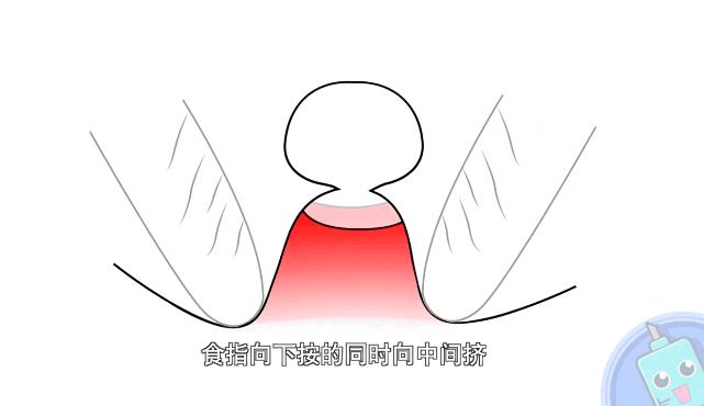 挤痘怎样才能不留痘坑,挤痘痘不留痘印的小妙招