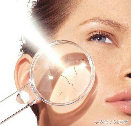 你有雀斑黄褐斑吗,脸黄长褐斑