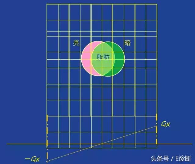 磁共振伪影及解决方案,e系列诊断