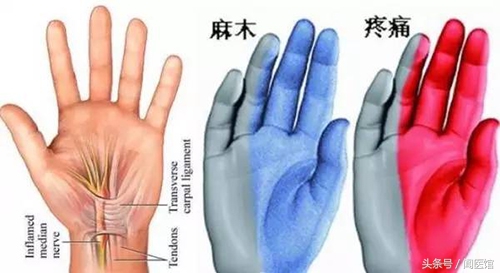 跟着练：握紧拳头，再松开，出现握拳无力、手抖晃动真要注意了