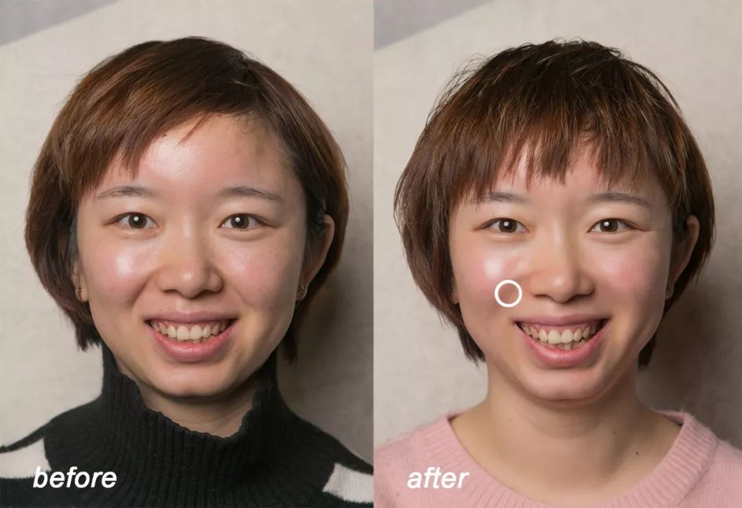 小茂肌诊室∣美容仪挑战：家用美容仪到底值得投资吗？