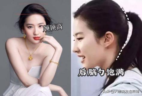 2500单位发际线,2000单位植发