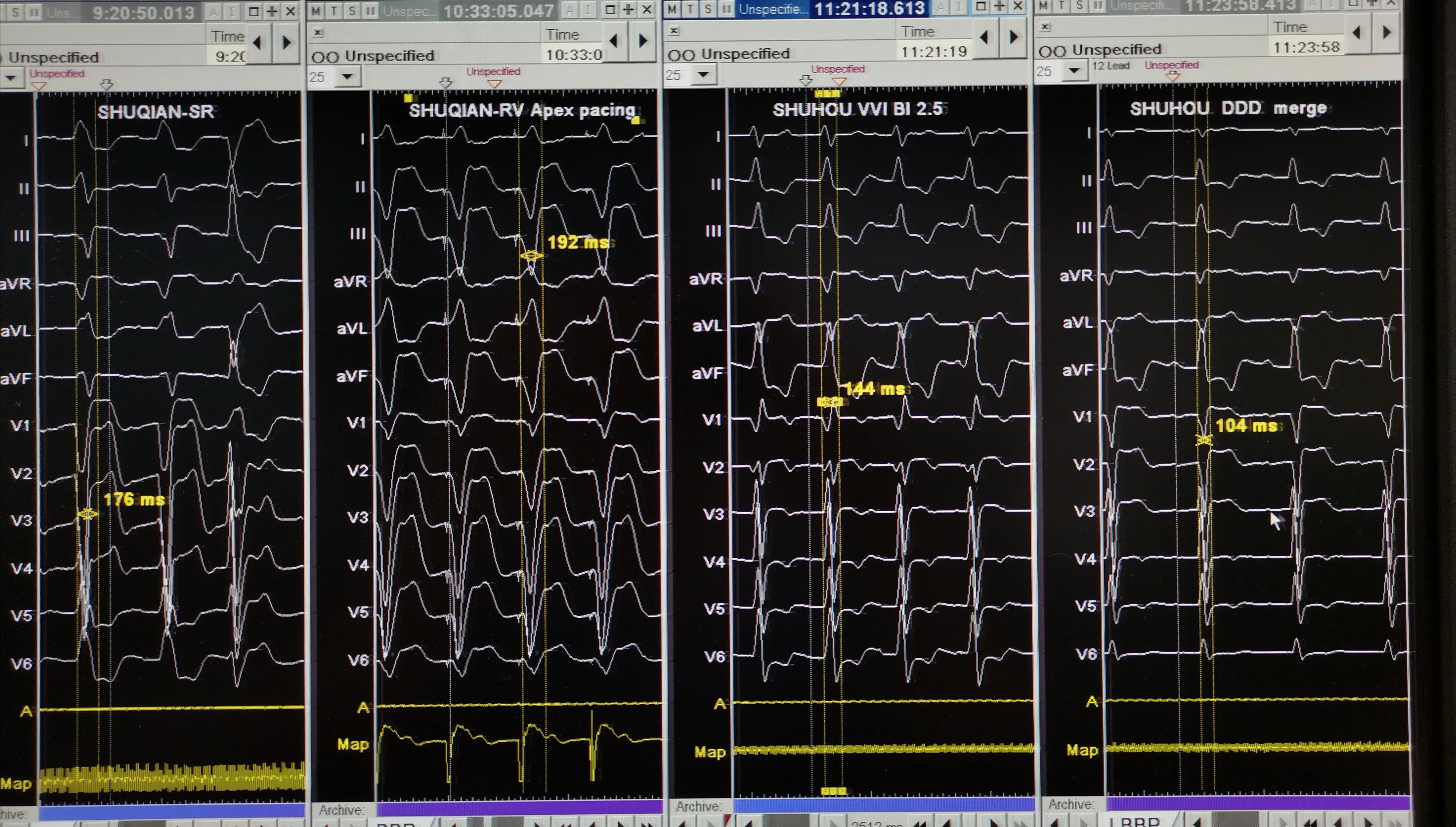 88岁老人心跳过快需要装起搏器吗,老人胸闷气短找中医看可以吗