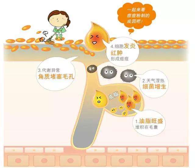 男生脸上斑点痘印很多怎么办,祛痘淡化痘印妙招男生专用