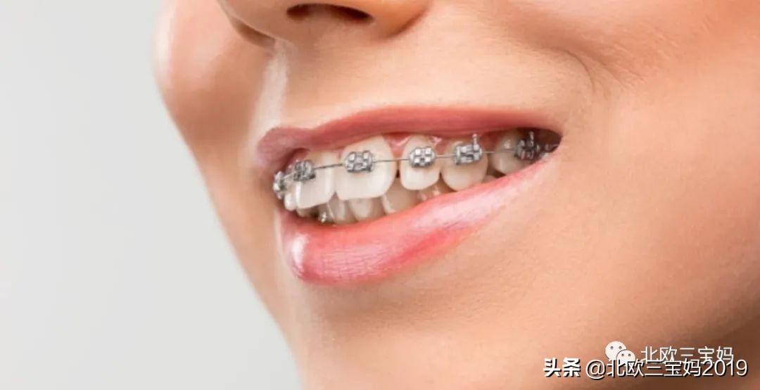 5岁小孩打全麻治蛀牙有影响吗,3岁孩子全麻风险大吗