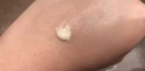 对眼纹有效果的眼霜推荐女生,年纪轻轻眼睛周围长细纹