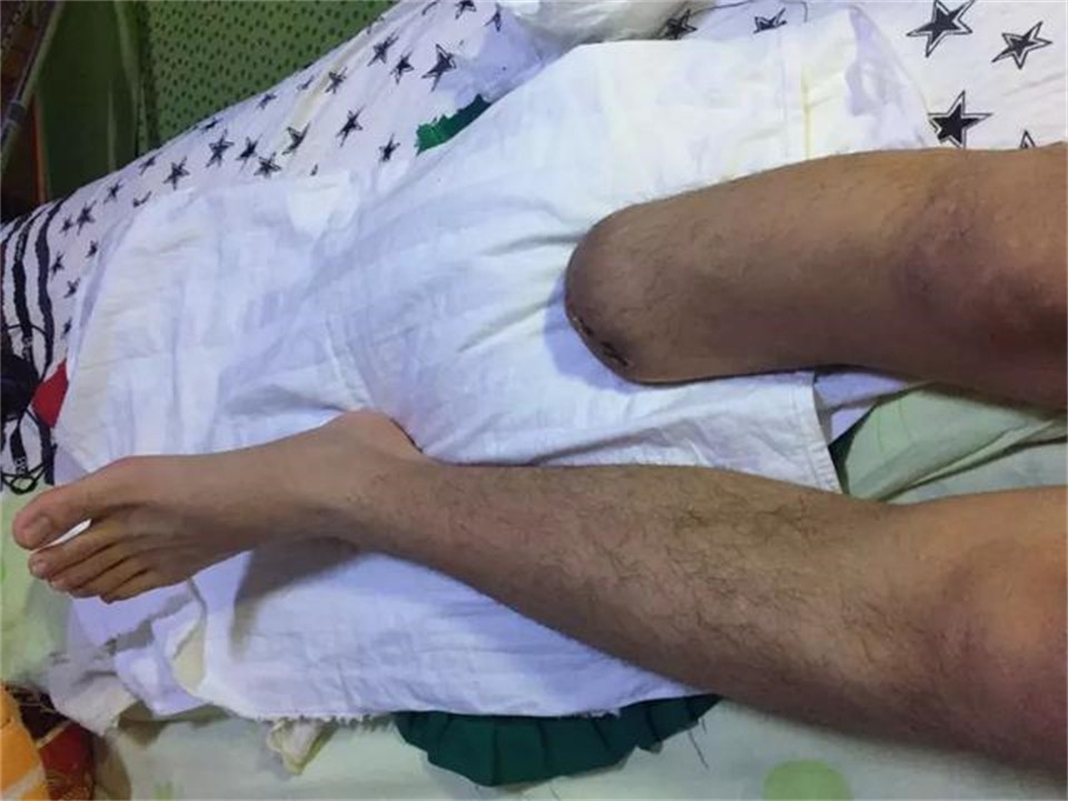 壁虎为什么有再生尾巴的能力,壁虎的尾巴再生原理