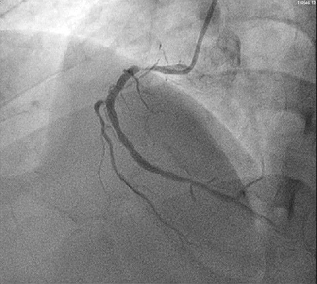 心脏像针扎的疼吃什么药,吃了很多药嗓子还是疼