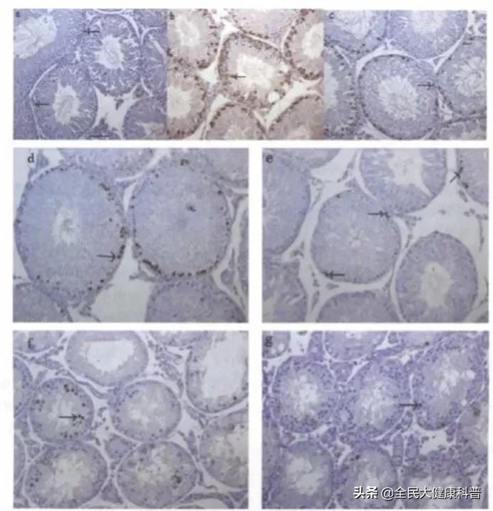枸杞的补肾效果为什么好,枸杞补肾是真的吗科普