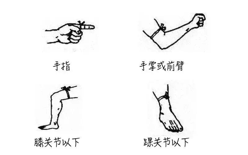 怀孕被毒蛇咬了小孩可以生下来吗,孕妇被毒蛇咬了怎么办