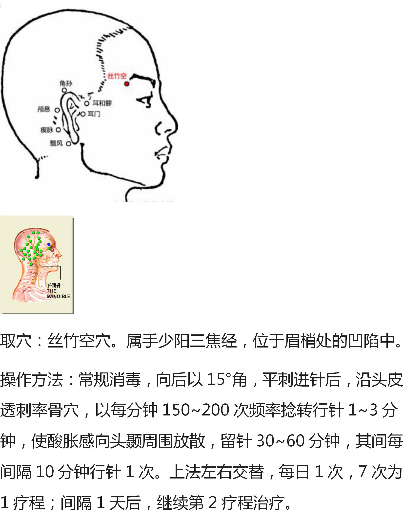 各种痛症的针灸方法,董氏奇穴大拇指腱鞘炎针灸取穴
