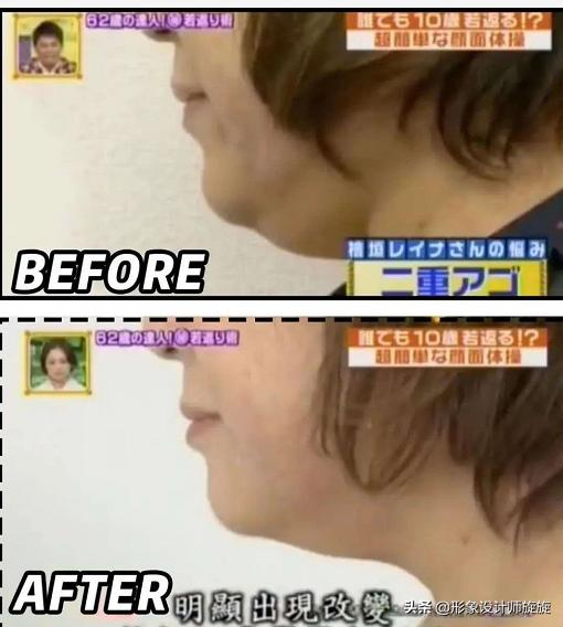 学生怎么让方脸变小v脸,脸大脸宽怎么科学变小