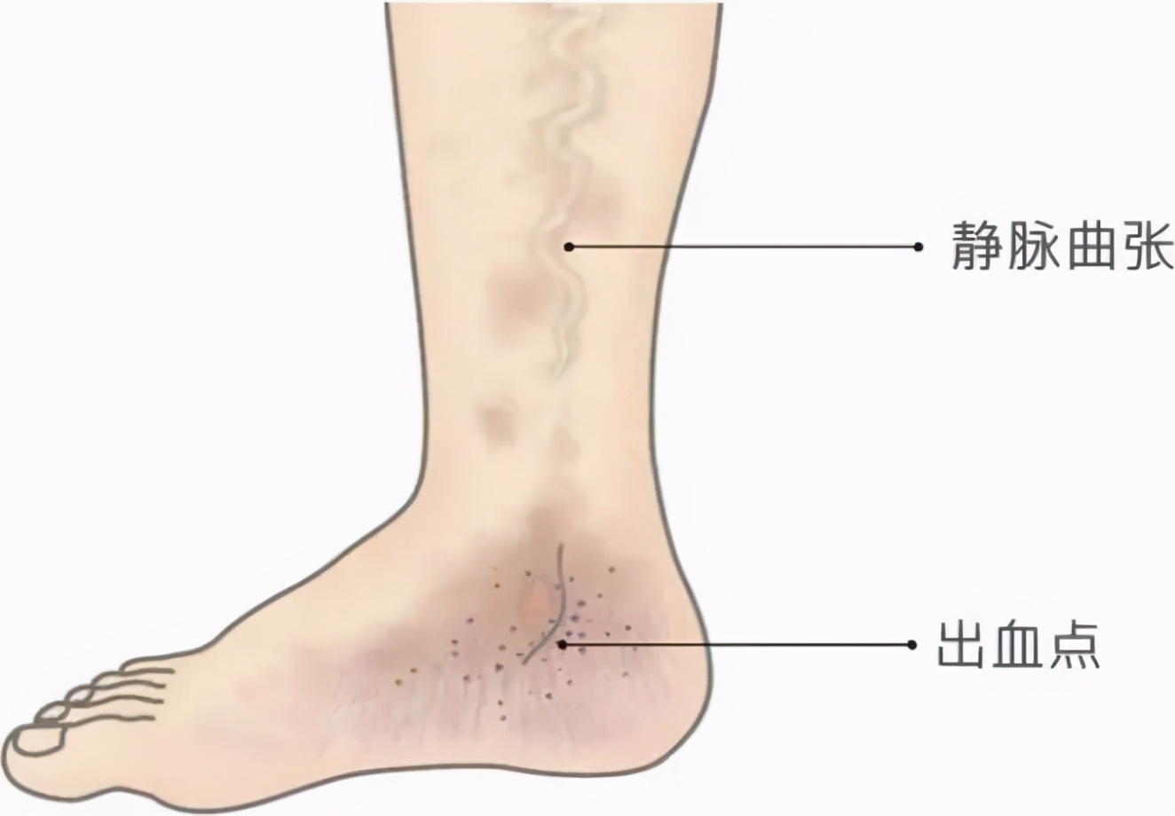 西安红会医院心血管住院部,西安市红会医院心血管内科地址