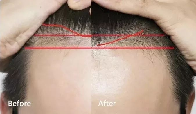 双十一适合买什么,双十一来了是买还是不买