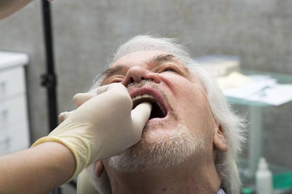 嚼槟榔10年口腔出现白斑怎么办,嚼槟榔为啥口腔变小了还能恢复吗