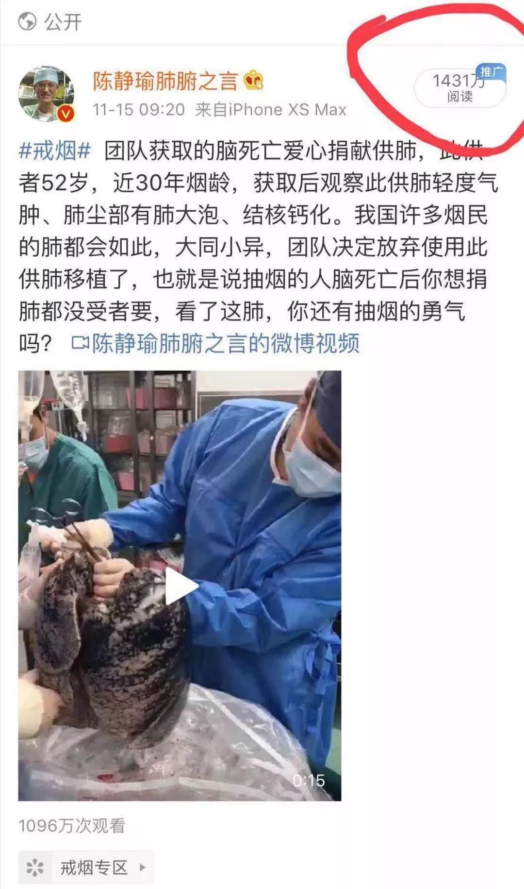 不过肺的抽烟方式有哪几种,吸烟怎么才可以不过肺