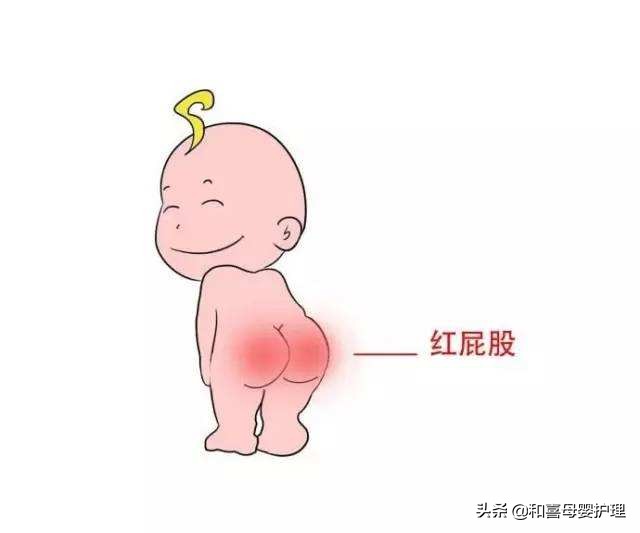 宝宝红屁股最有效的方法,宝宝红屁股了怎么弄好得快