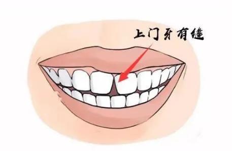 6-12岁儿童换牙的顺序图片,6-12岁换牙的顺序