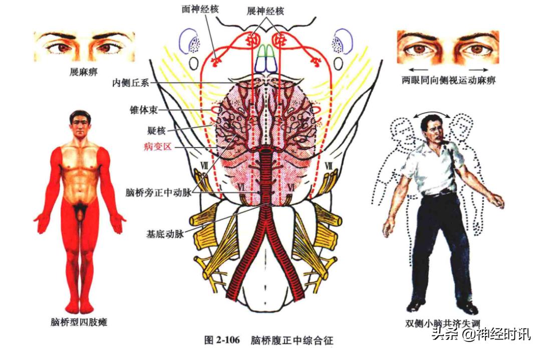 脑干解剖,脑干神经解剖