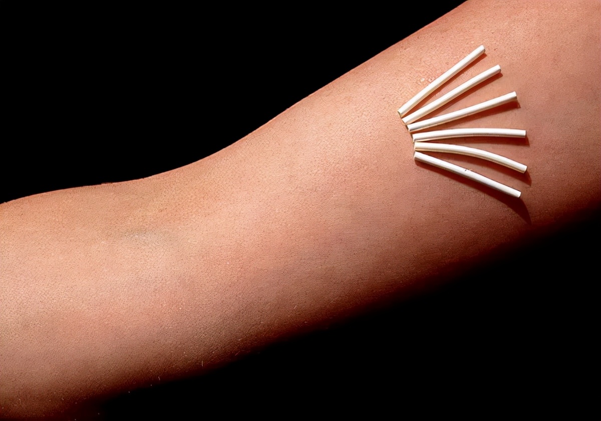 怎样避孕安全又高效,安全的避孕方式你会选哪几种