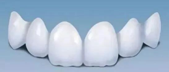 琚墮鍖诲拷鎮犲仛浜嗗叏鐡风墮瀵艰嚧鍢村嚫,鎻鐗欏尰璇寸殑鍏ㄧ摲鐗欏埌搴曟湁澶氬ソ