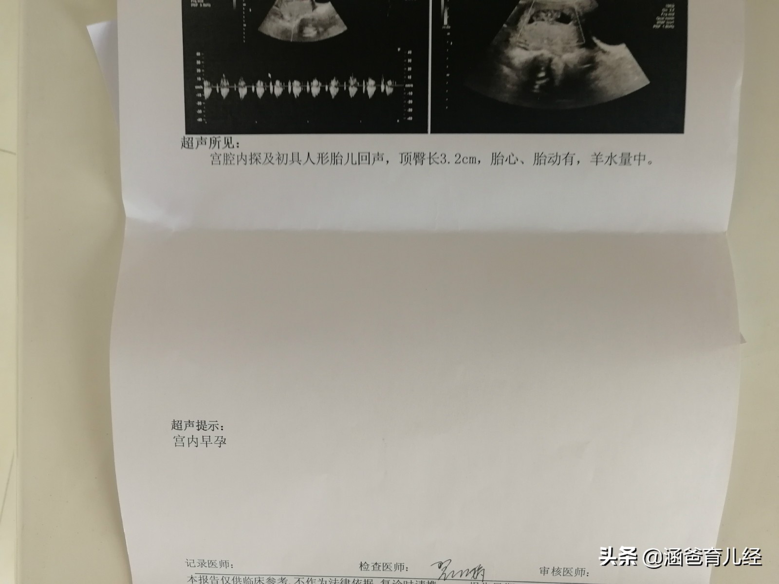 怀孕10周见红保胎多久,老婆怀孕检查b超