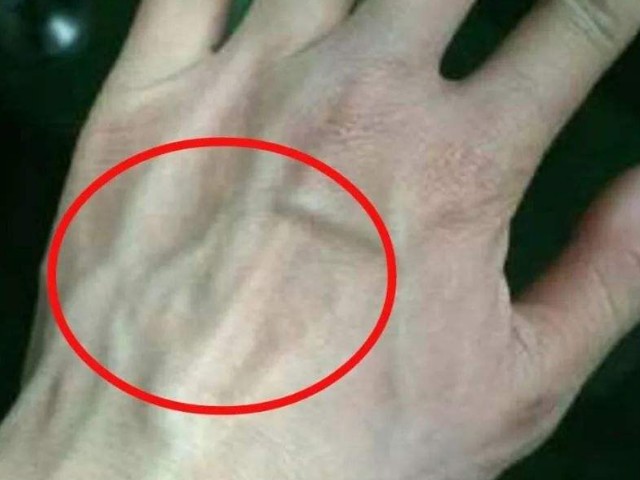 身上看到青筋什么原因,小腿能看见青筋正常吗