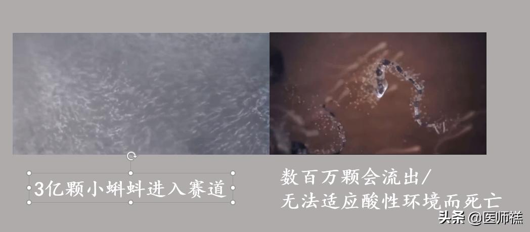 备孕期间要清醒！同房后倒立增加受孕率？尝试这些办法或许更高效