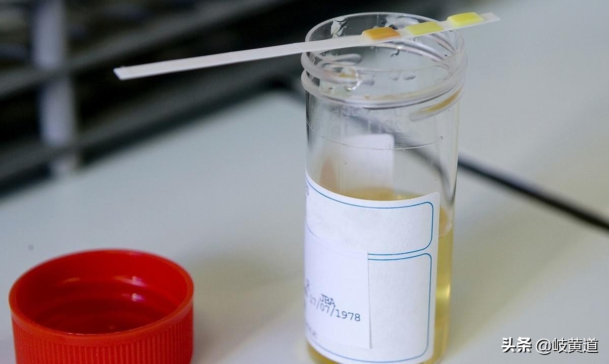 尿路感染引起的尿频尿急的症状,最近尿路感染尿频尿急怎么办