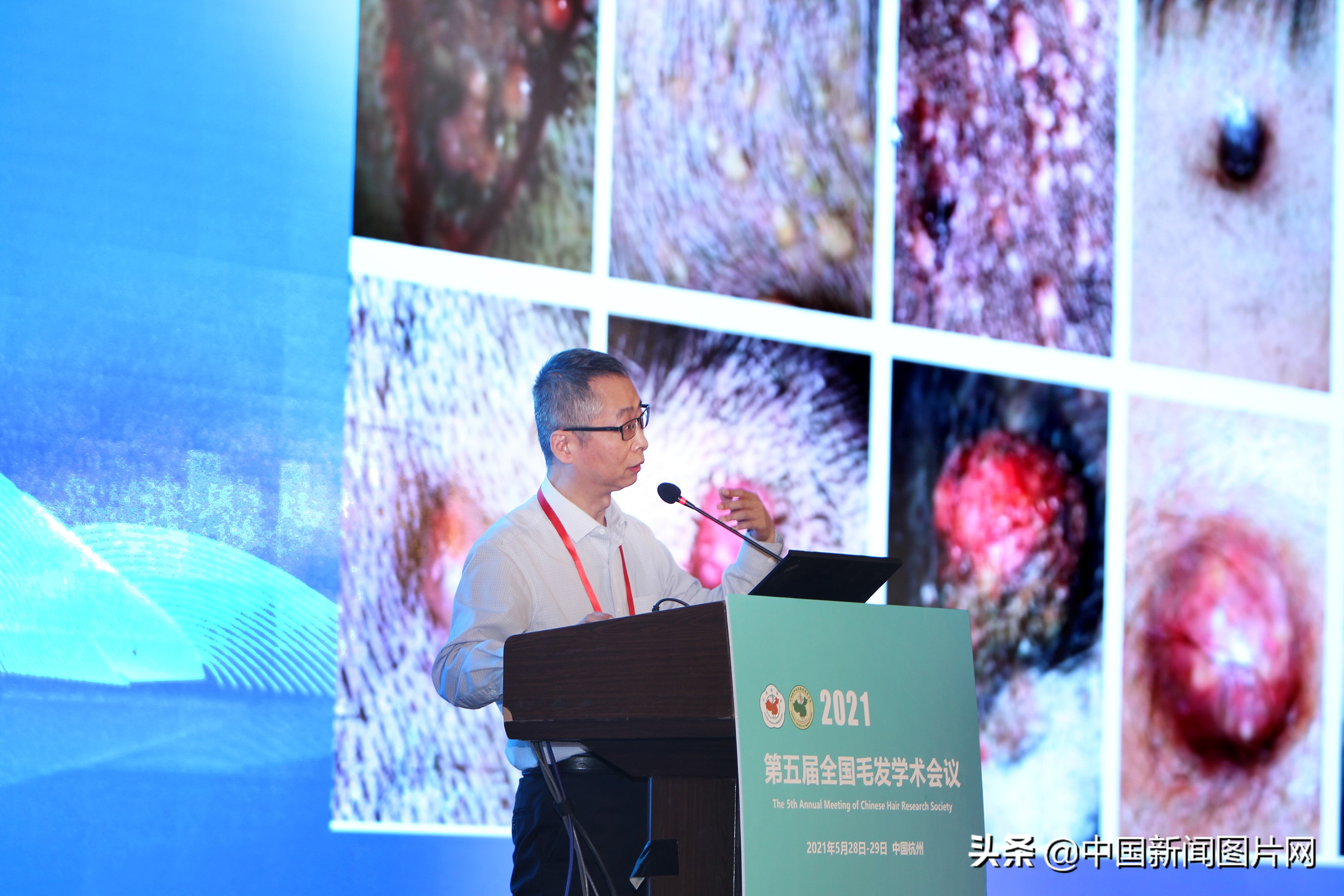 毛发学术会议,全国毛发学术研讨会