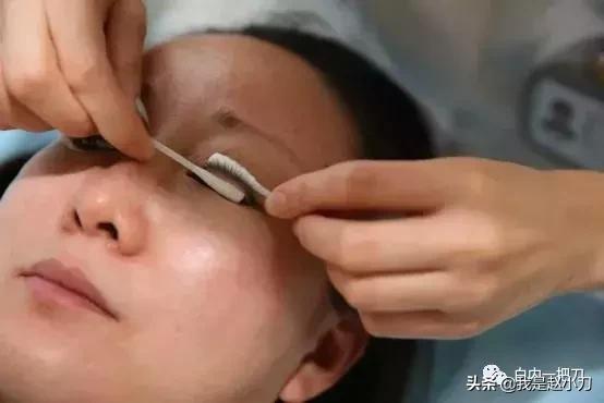 干眼症中医治疗好还是西医治疗好,干燥综合症引起的干眼症怎么治疗