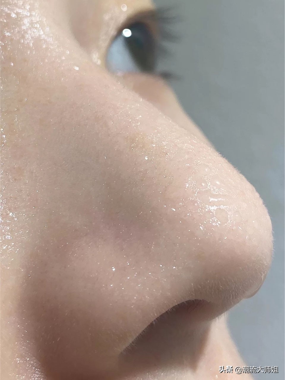 鸡蛋液去黑头有效吗,干货分享去黑头小诀窍让皮肤美腻