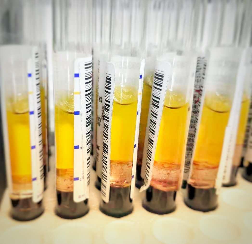 去医院抽血了但是没报告,医院查血一管到底抽了多少