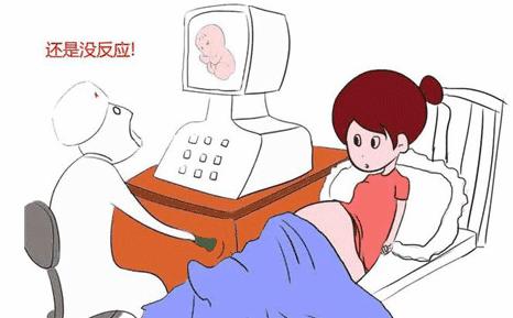 什么是催产针?为什么要催产?孕期冷门功课