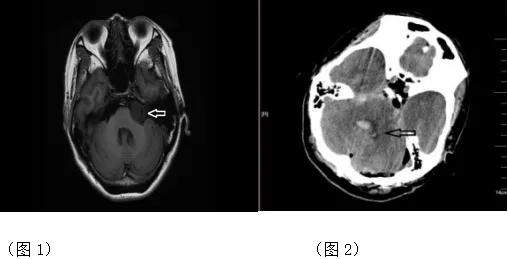 全麻未完全清醒,全麻未清醒应该什么卧位
