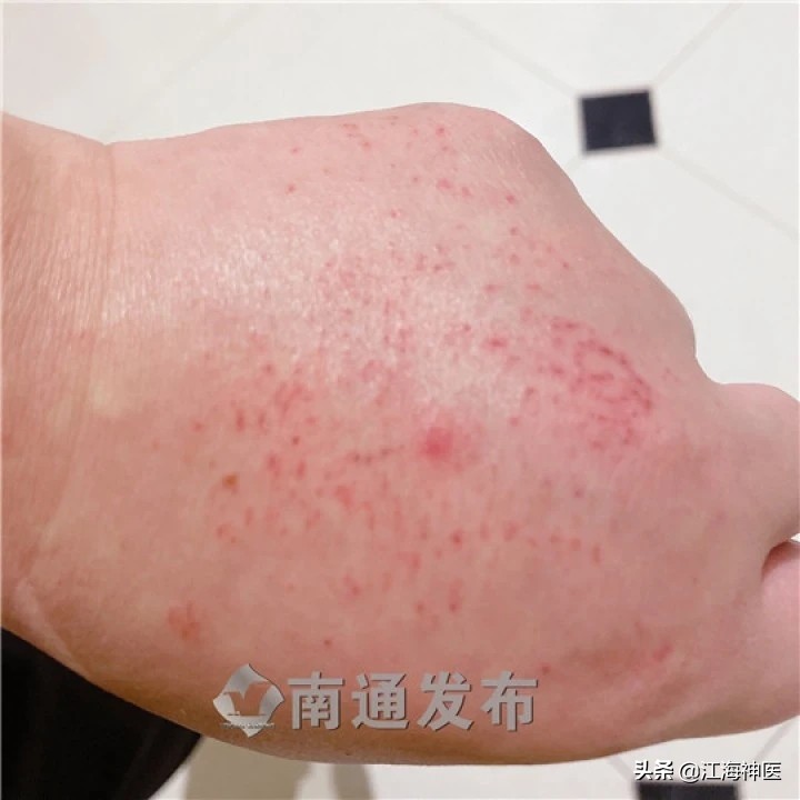 疫情暴发后，这个95后如东姑娘竟孤身一人去了武汉！