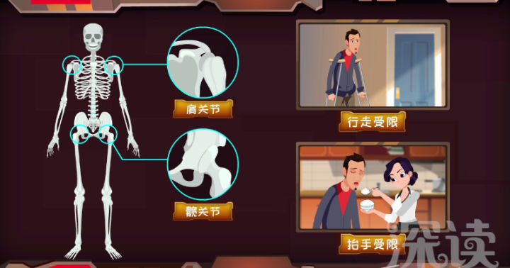 驼背治疗后身高,少年驼背医学手术矫正