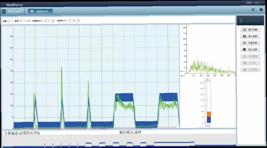 子宫全切恢复正常以后注意什么,腹腔镜子宫切除术后恢复注意事项
