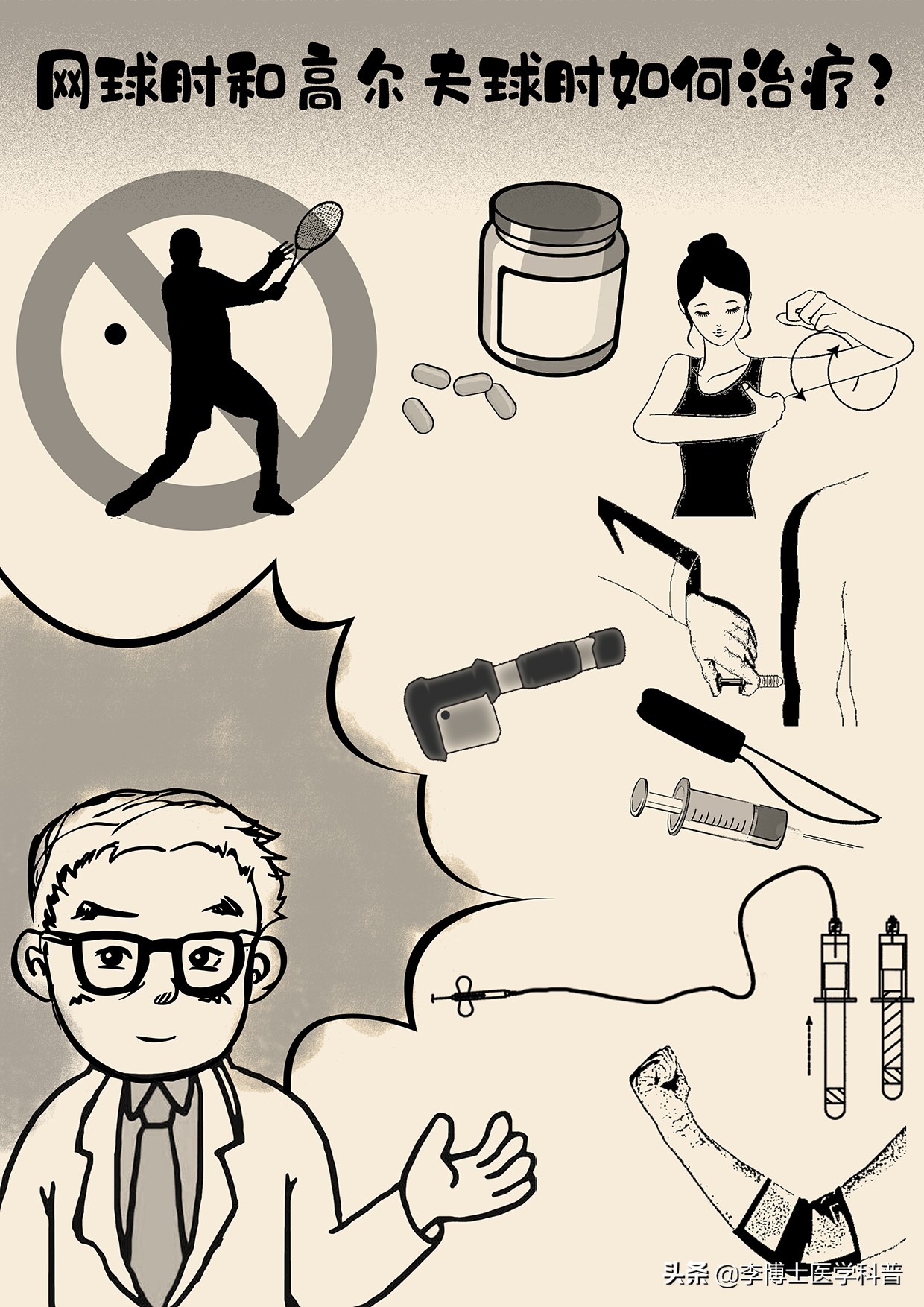 网球肘和高尔夫球肘会同时得吗,网球肘和高尔夫肘如何防治