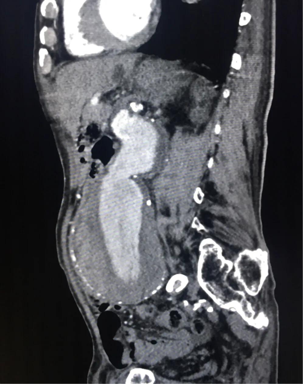 肚子疼要担心吗,肚子疼就是不来事儿