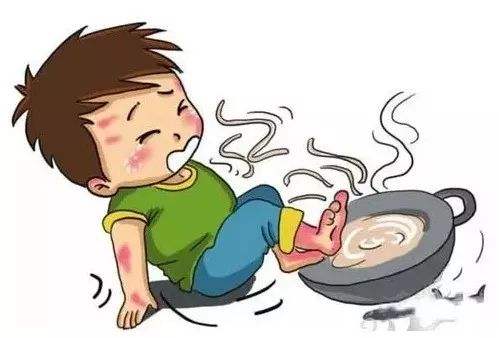 烧伤几天后局部变红感觉很痒,烧伤伤口痒可以用什么药