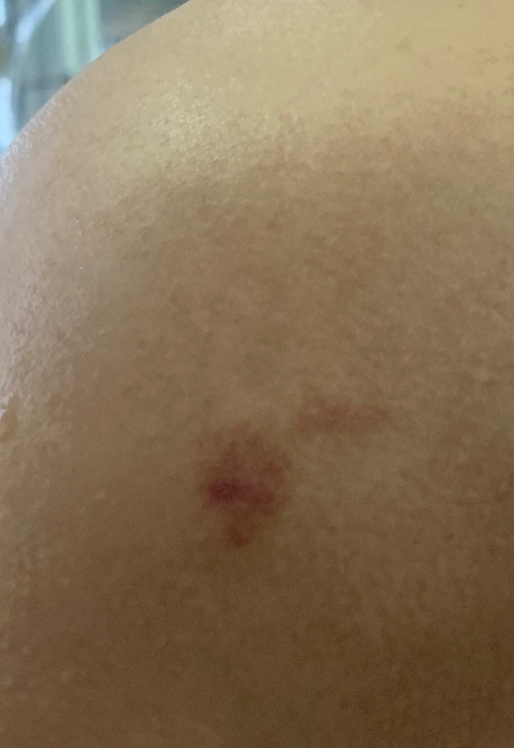 猫咪一块长了个红包还秃了千万要重视